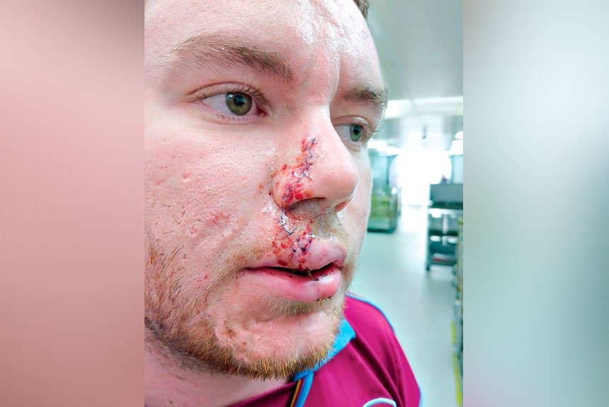 UNDER ATTACK: There have been 1420 dog-related incidents.