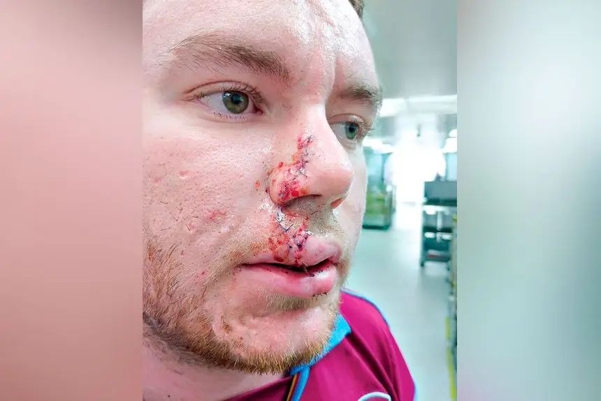 UNDER ATTACK: There have been 1420 dog-related incidents.