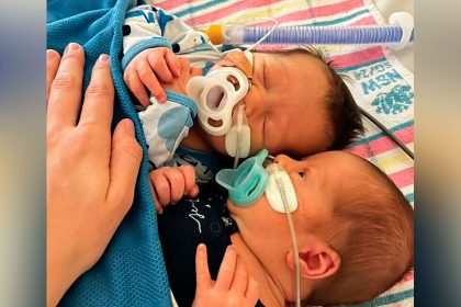 SERIOUS VIRUS: Twins Callum and Sam were hospitalised for weeks with RSV before the program was available.