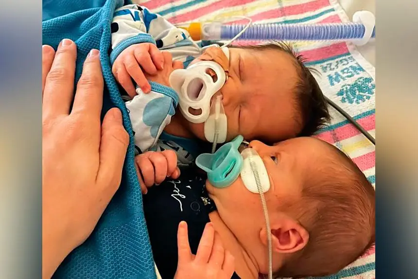 SERIOUS VIRUS: Twins Callum and Sam were hospitalised for weeks with RSV before the program was available.