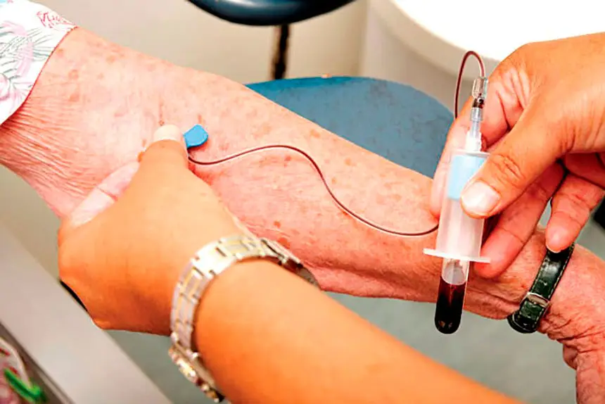 MAJOR ADVANCE: The blood test makes diagnosis more accessible for people living in regional and rural Australia.